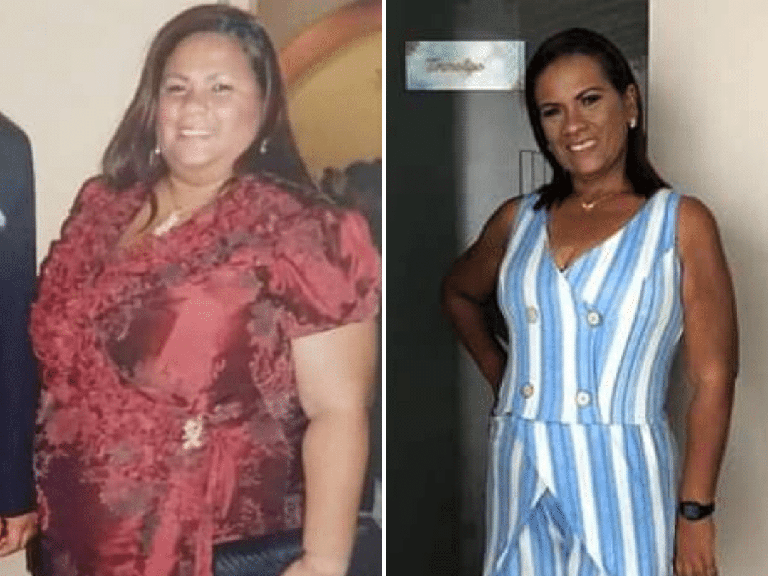 Ela aprendeu a não descontar a tristeza e ansiedade na comida e secou 63 kg