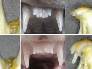 Finalmente! Japoneses criam remédio que faz crescer dentes; como funciona?