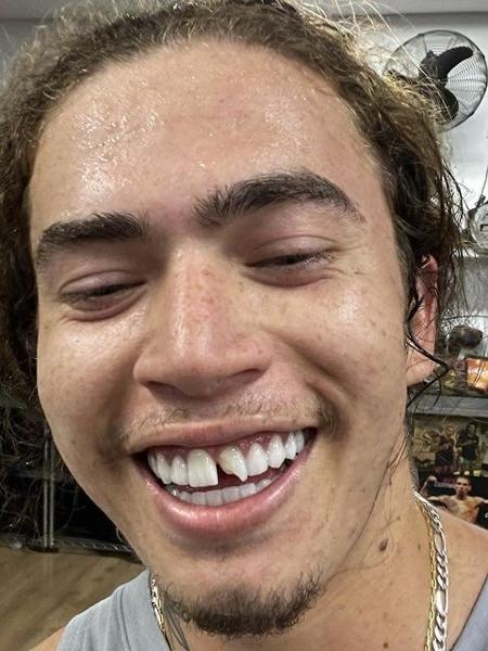 Whindersson Nunes exibe dente quebrado após treino - Reprodução / Instagram