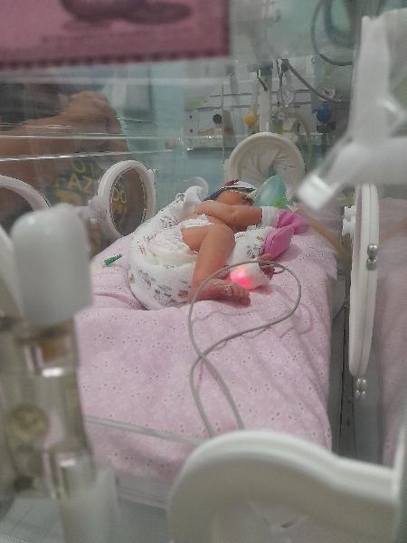 Amora nasceu de 34 semanas e ficou internada após o nascimento