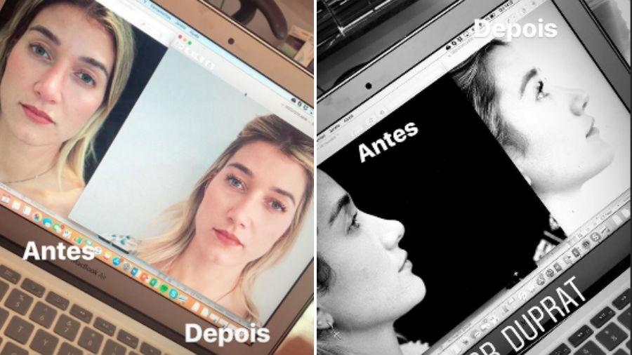 Gabriela Pugliesi mostra duas comparações de antes e depois da cirurgia no nariz - Reprodução/Instagram