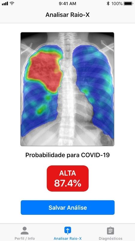 Imagem de diagnóstico em aplicativo desenvolvido pela Otawa Health  - Divulgação - Divulgação