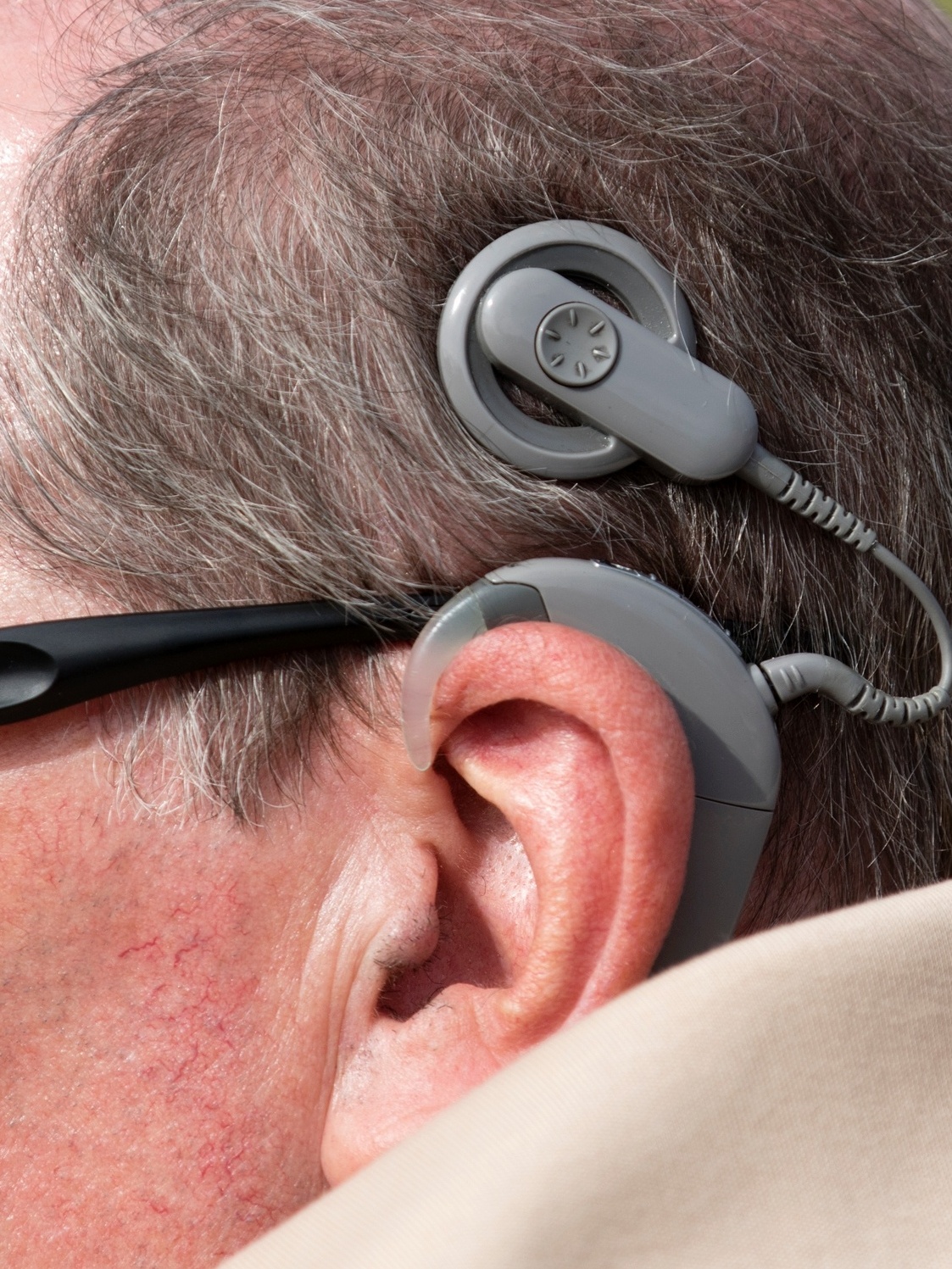 Qual a diferença entre o Implante Coclear e os aparelhos auditivos  convencionais?