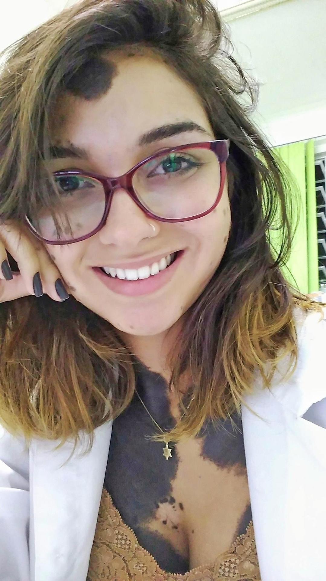 Beatriz nasceu com uma espécie de marca de nascença que cobre 80% de seu corpo. - HotSpot Midia