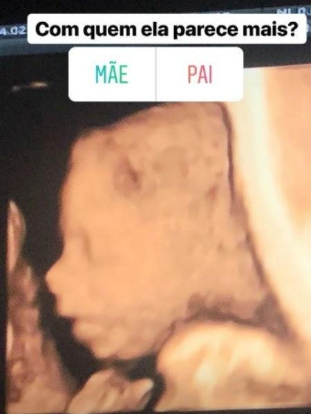 Sabrina Sato faz enquete sobre ultrassom da filha - Reprodução/Instagram - Reprodução/Instagram