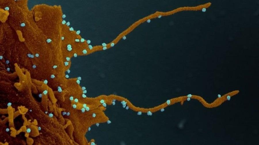 A célula infectada, seguindo as instruções do vírus (em azul), desenvolve longos tentáculos que permitem a infecção de outras células - ELIZABETH FISCHER, MICROSCOPY UNIT NIH/NIAID