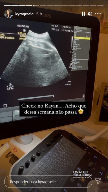 Ultra Kyra Gracie - Reprodução/Instagram - Reprodução/Instagram