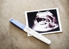 Debates: Precisa esperar 12 semanas para contar da gravidez? - Getty Images