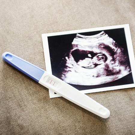 Alguns estados americanos têm criado obstáculos para que mulheres consigam realizar abortos legais - Getty Images