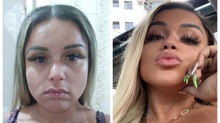 Monalisa Moura, 34, começou a fazer harmonização após se cansar de ver tantos "defeitos"" no rosto - Arquivo pessoal