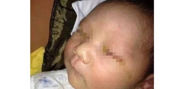 O bebê que teria perdido a visão em um olho depois de uma foto com flash, que estaria muito perto do rosto - People"s Daily/Reprodução