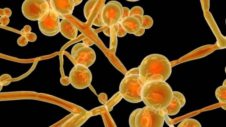 A maioria das infecções por Candida auris documentadas no mundo aconteceram em ambientes hospitalares - Getty Images