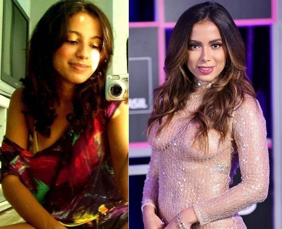 Anitta cresceu na internet. Por isso, é fácil encontrar imagens da cantora antes da fama. Aos 15 anos, a adolescente Larissa de Macedo Machado adorava tirar fotos no espelho para postar no Orkut e Fotolog, as redes sociais da moda antes de Facebook e Instagram. Com 25 anos, a cantora está quase irreconhecível após cirurgias plásticas - Montagem/UOL