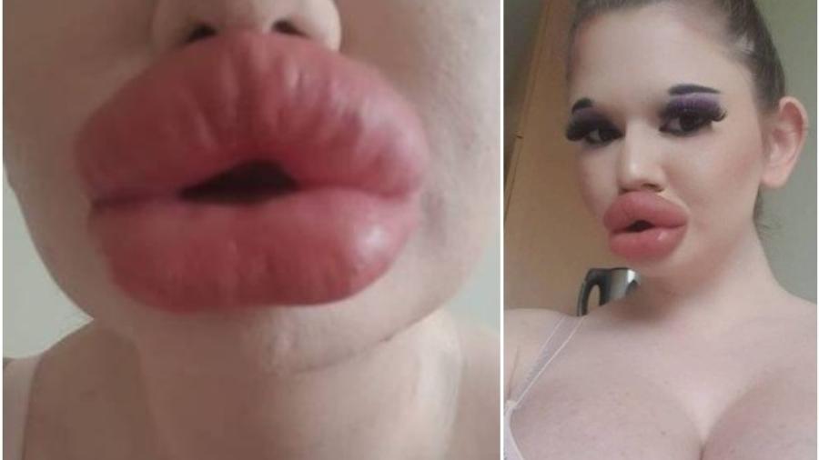 Andrea Emilova Ivanova diz possuir os maiores lábios do mundo e quer aumentá-los ainda mais - Reprodução: Instagram