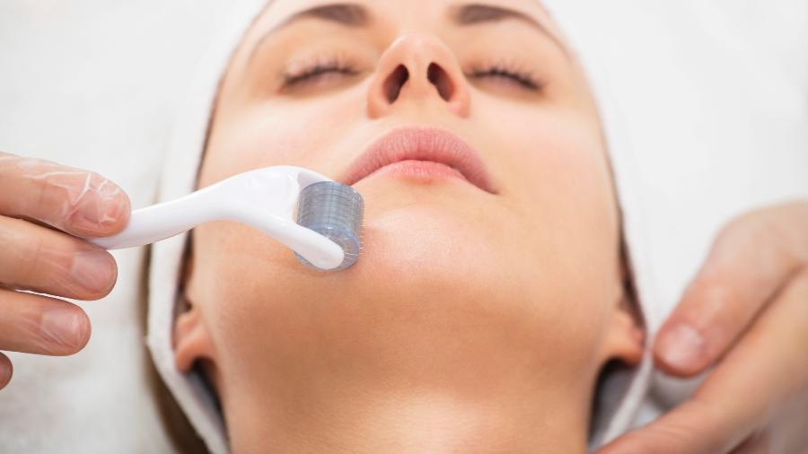 Microagulhamento pode ser utilizado nos lábios, rosto, couro cabeludo e corpo - iStock