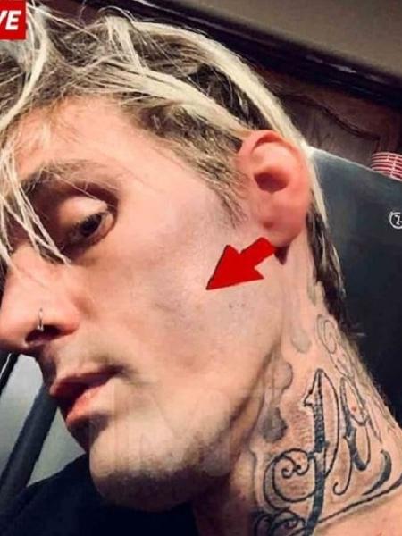 Aaron carter - Reprodução/TMZ - Reprodução/TMZ