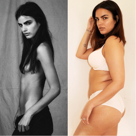 Liza Golden-Bhojwani postou uma foto de seu ?antes e depois? - Reprodução/Instagram