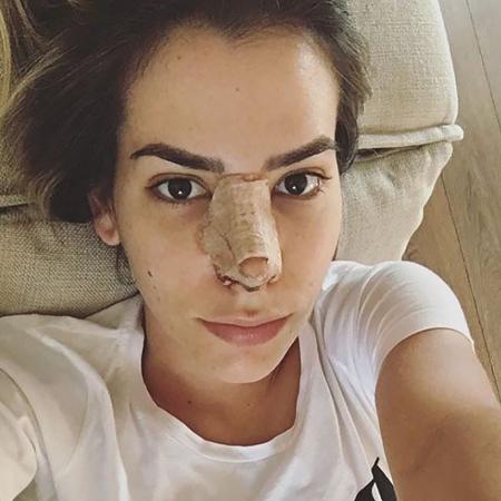 A ex-BBB Adriana Sant"anna, que se submeteu a uma nova plástica no nariz - Reprodução/Instagram