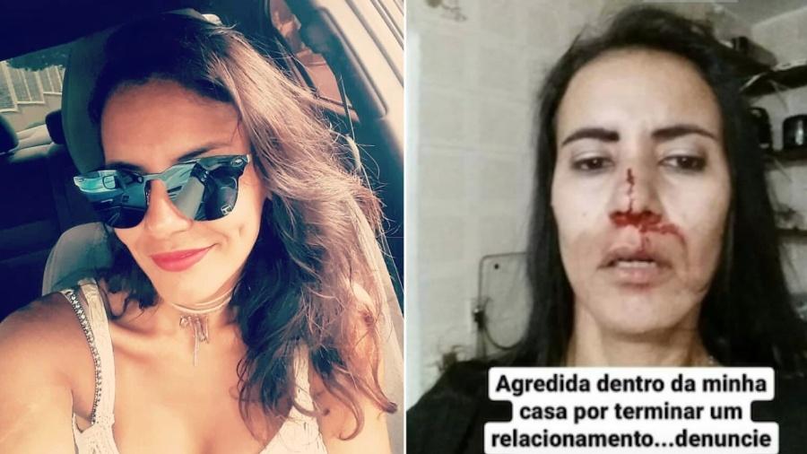 Veterinária Cristiane Budib mostra ferimentos no rosto e diz ter sido agredida por ex-namorado - Reprodução/Instagram