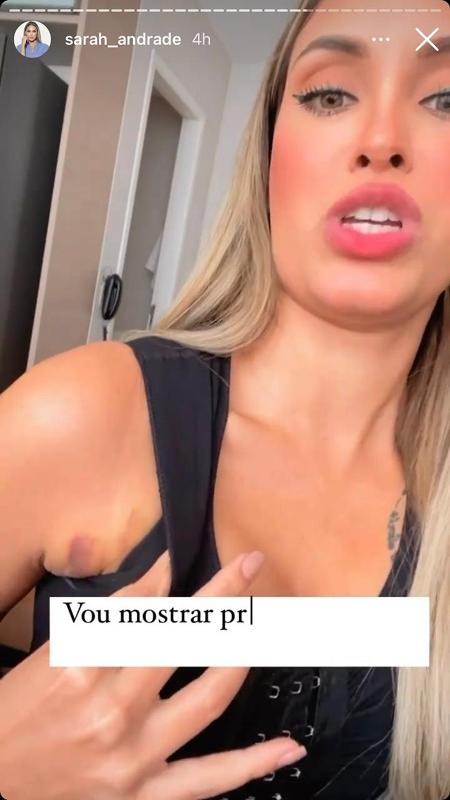 Sarah Andrade mostrou marcas em vídeo - Reprodução/Instagram @sarah_andrade - Reprodução/Instagram @sarah_andrade