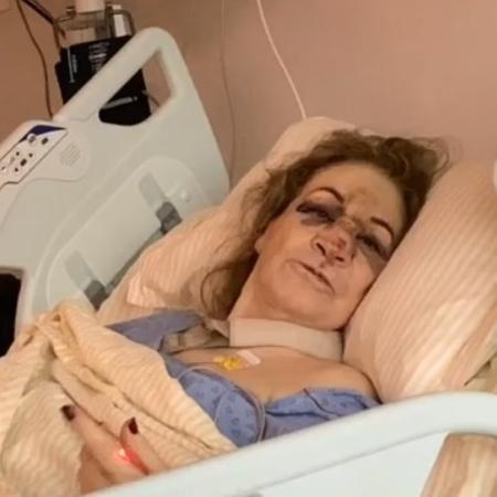 Mãe da apresentadora Sonia Abrão, Cecília Abrão teve fraturas no braço e na face - Reprodução / Instagram @soniaabrao