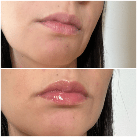 Comparativo da boca com e sem o 3D Hydra Lipgloss