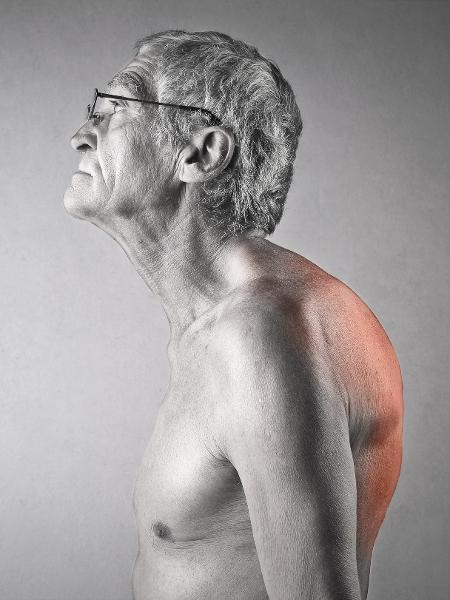 cifose, coluna, postura - iStock - iStock