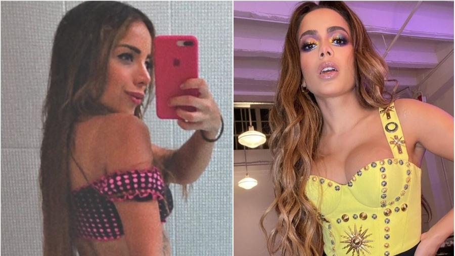 Larissa Andjara e Anitta: modelo fez harmonização facial para ficar parecida com a funkeira - Reprodução/Instagram