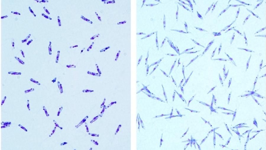 À esquerda, cultura de parasitas da espécie Crithidia sp LVH60A; à direita, cultura in vitro da espécie Leishmania infantum  - Luana Rogerio/UFSCar