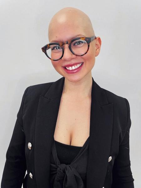 Yasmin Martinez tem alopecia desde os 8 anos de idade - Arquivo pessoal