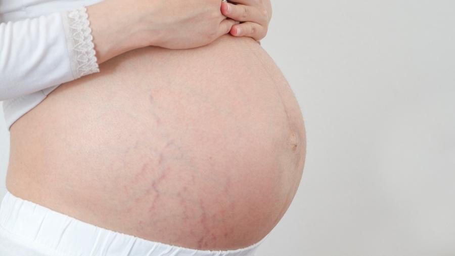 Saiba se é normal bebês mexerem muito ou pouco na gravidez - iStock