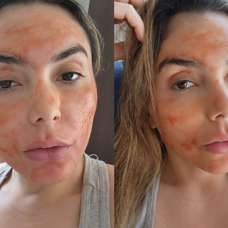 Faço máscara facial com o sangue da minha menstruação e isso mudou a  maneira de me enxergar