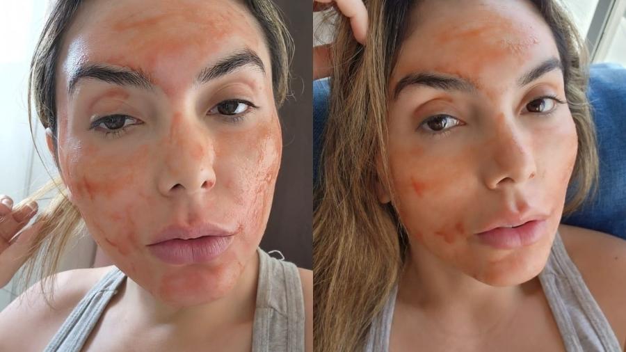 Modelo e influencer Mimi Boliviana revelou um truque diferente para manter a pele do rosto firme  - Divulgação / CO Assessoria