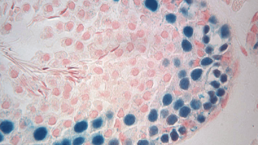 Células-tronco de espermatozoides de camundongos foram transplantadas e capazes de produzir esperma - Eoin Whelan, Whelan et al., 2022, PLOS Biology, CC-BY 4.0