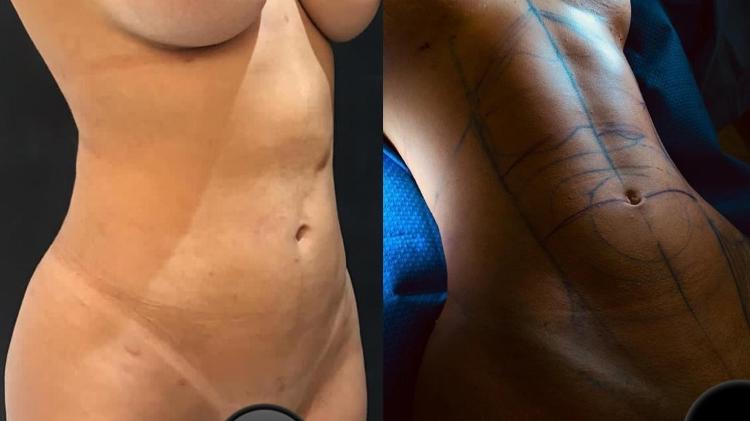 1 - Divulgação Ari Prensa/ JK Estética Avançada - Divulgação Ari Prensa/ JK Estética Avançada