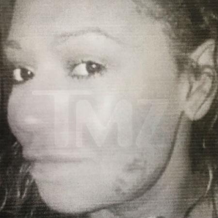 Mel B aparece com hematoma no rosto em foto publicada pelo TMZ; ela acusa o ex-marido de agredi-la - Reprodução/TMZ - Reprodução/TMZ