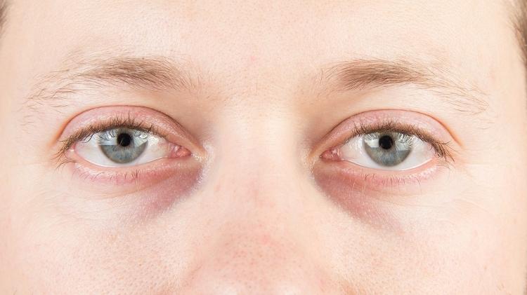 Olheira - iStock - iStock