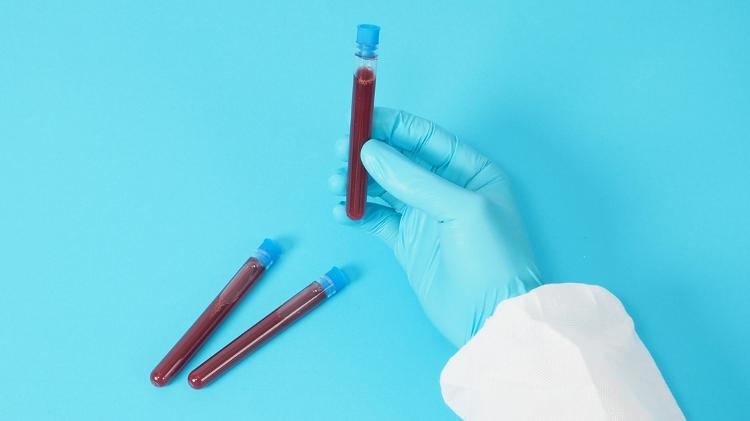 Os exames de sangue fornecem aos médicos mais informações para orientar diagnósticos e decisões de tratamento.