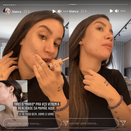 Bianca Andrade mostrou acne no rosto após dar à luz ao filho Cris - Reprodução/Instagram