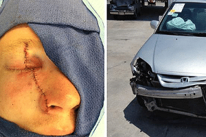 Corey Burdick, 26 anos, ferido por airbag do Honda Civic 2001  - Reuters/Newsome Melton Law Firm - Reuters/Newsome Melton Law Firm