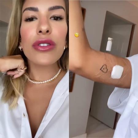Lore Improta exibe braço após retirar implante contraceptivo - Reprodução / Instagram