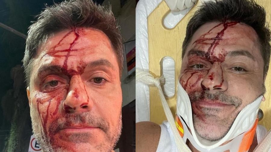 Danilo Faro, irmão de Rodrigo Faro, sofre acidente de carro - Reprodução/Instagram
