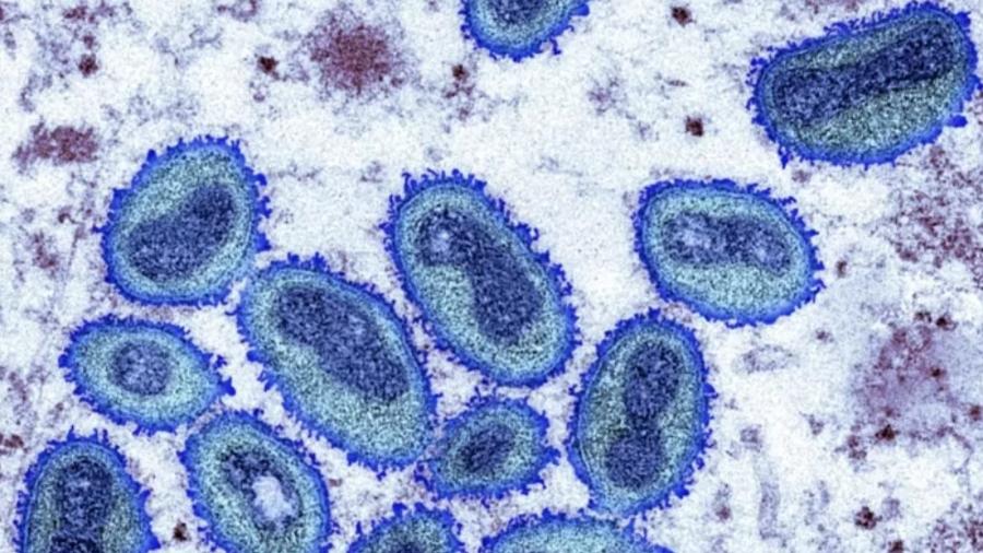 Especialistas acreditam que a vacina contra a varíola humana tem alta eficácia contra a dos macacos - Science Photo Library