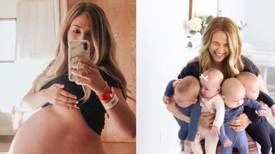 Foto de "antes e depois" de mãe de quadrigêmeos viraliza - Reprodução/Instagram