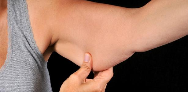 Pele flácida após emagrecer rápido: o que fazer para recuperar a firmeza