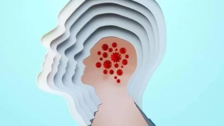 E se micróbios dormentes ativarem o desenvolvimento do mal de Alzheimer? Esta é uma teoria que poderá ter profundas implicações para a prevenção da doença. - Getty Images/BBC