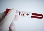 Empresa é processada por visar lucro e atrasar remédio promissor contra HIV (Foto: iStock)