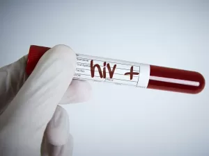 Jovens estão vulneráveis ao HIV: por que isso acontece e como protegê-los?