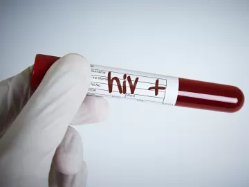 Diretoria da Fundação Saúde renuncia após caso de órgãos com HIV no RJ