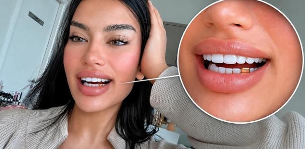 Influenciadora transforma aliança em grillz após traição